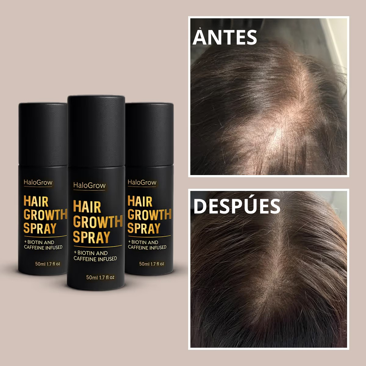 Cabello más grueso y saludable con HairGrowth Spray